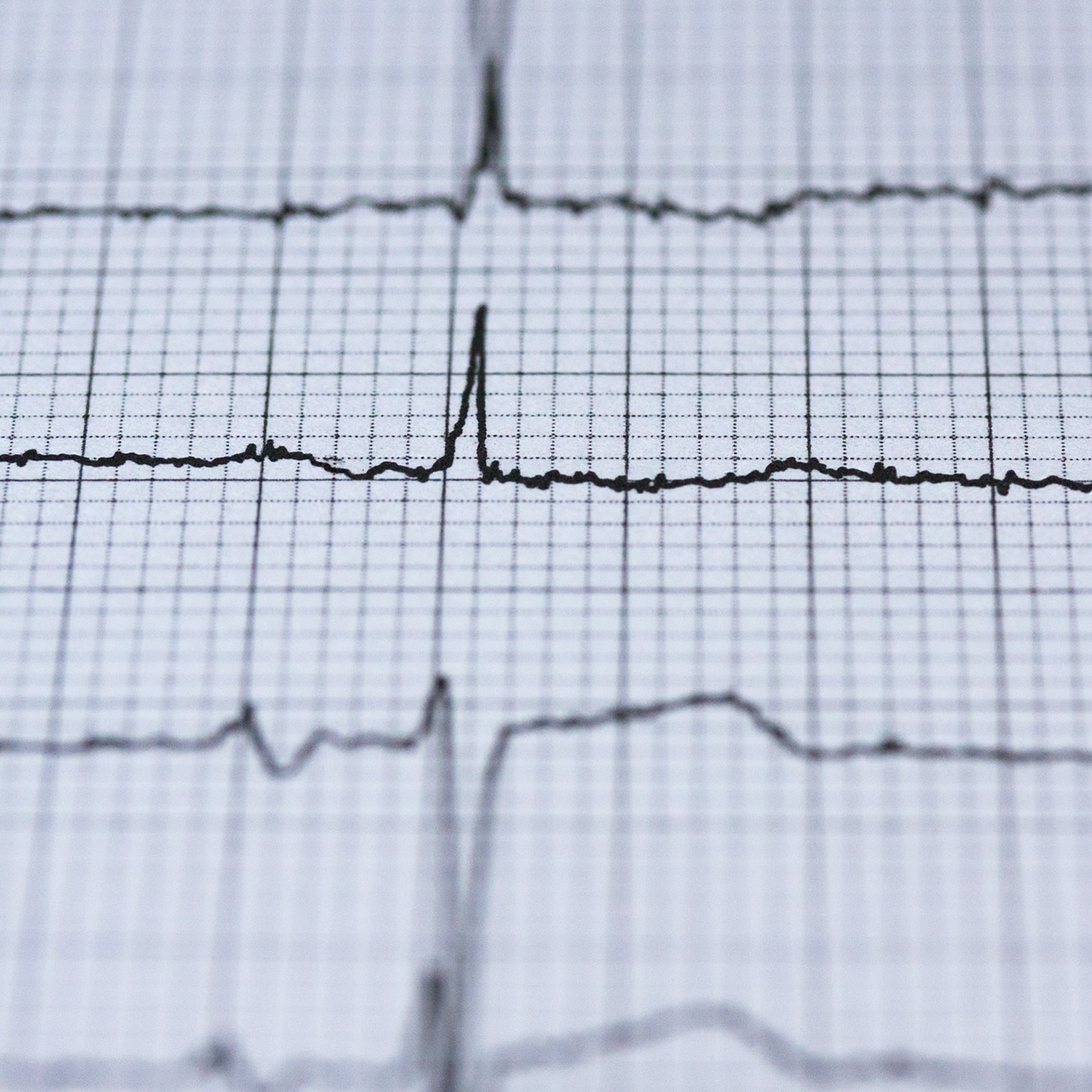 Lubelska Akademia WSEI – Podyplomowe – Kurs specjalistyczny w zakresie Wykonania i interpretacji zapisu EKG